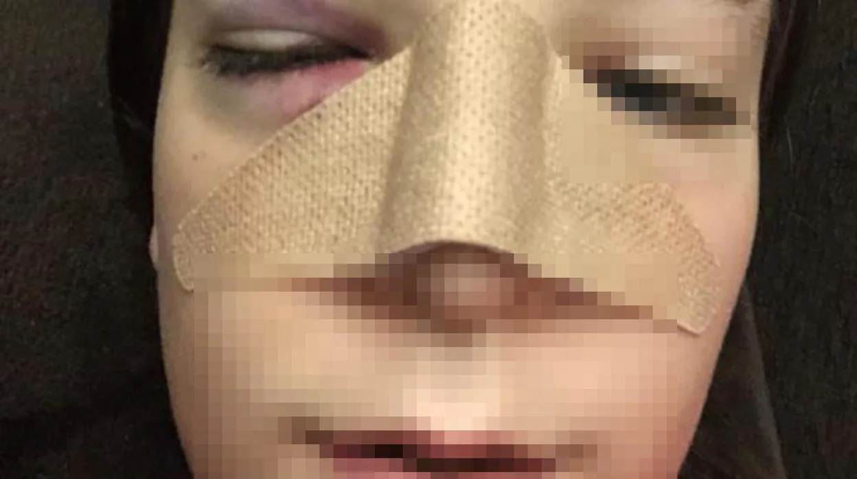Un menor rompe la nariz a una compañera en el instituto Álvar Núñez de Jerez