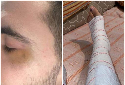 Un joven sufre una agresión en Chiclana por ser «discapacitado y gay»