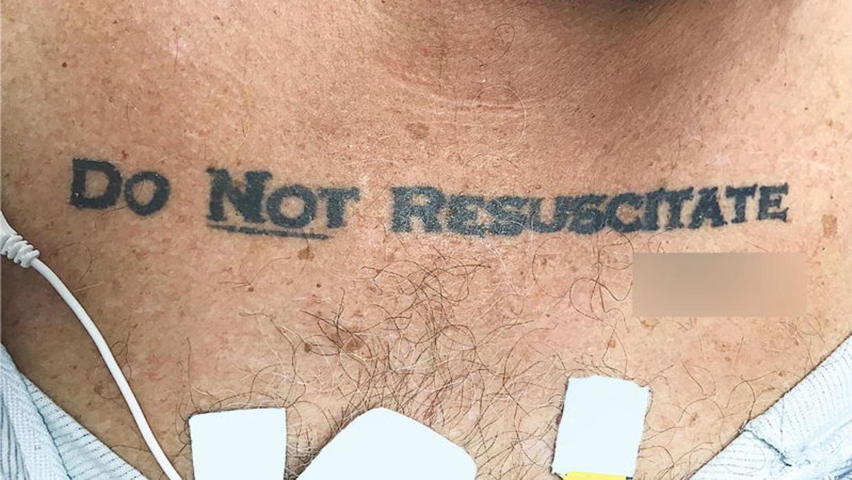 El dilema al que se enfrentaron unos médicos ante un paciente inconsciente con el tatuaje «No resucitar»