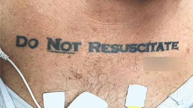 El dilema al que se enfrentaron unos médicos ante un paciente inconsciente con el tatuaje «No resucitar»