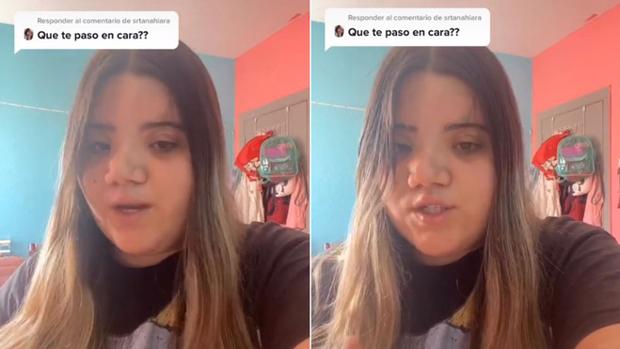 Las redes sociales se vuelcan con Inma Franco, una joven extremeña a la que critican por su aspecto físico