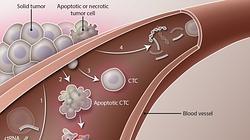 La biopsia líquida detecta los restos del cáncer en la sangre