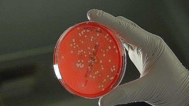 Bacterias en una placa Petri