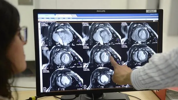 En la imagen detalles de un infarto en el laboratorio de investigacion en imagen cardiovascular