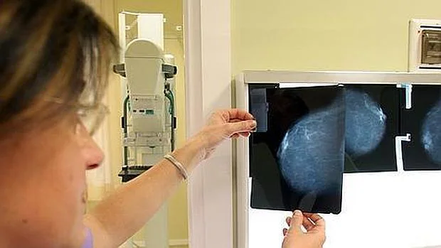 Una profesional examina una mamografía