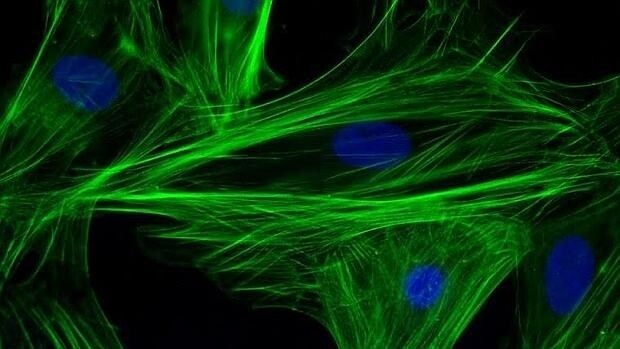 Células del miocardio conectadas por filamentos de actina