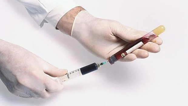 Ya no es necesario ayunar antes de un análisis de sangre para medir el  colesterol