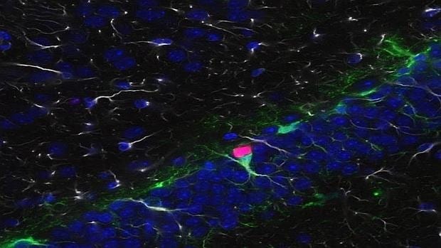Proliferación de células progenitoras neuronales (verde) con expresión normal de FMRP (rojo)