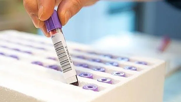 La ELA podría llegar a detectarse precozme a través de un test sanguíneo