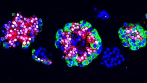 Imagen por inmunofluorescencia de una muestra de islote pancreático humano tratada con artemisina