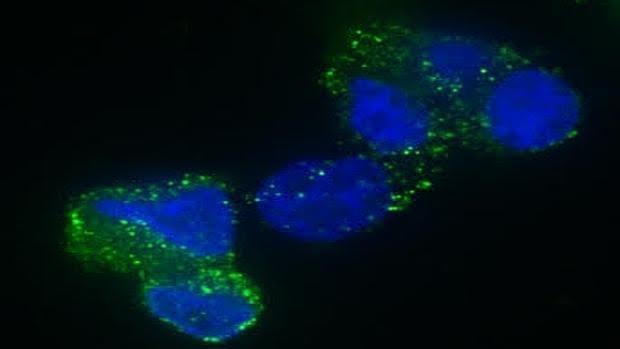 Células madre de glioblastoma multiforme