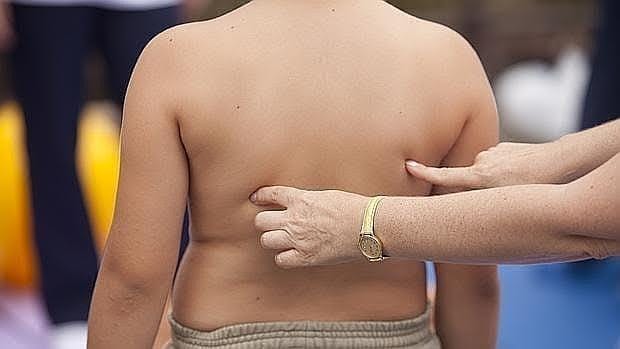 El 10% de los niños españoles padece obesidad