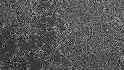 Células progenitoras y hematopoyéticas (HSPC) de células iPS humanas