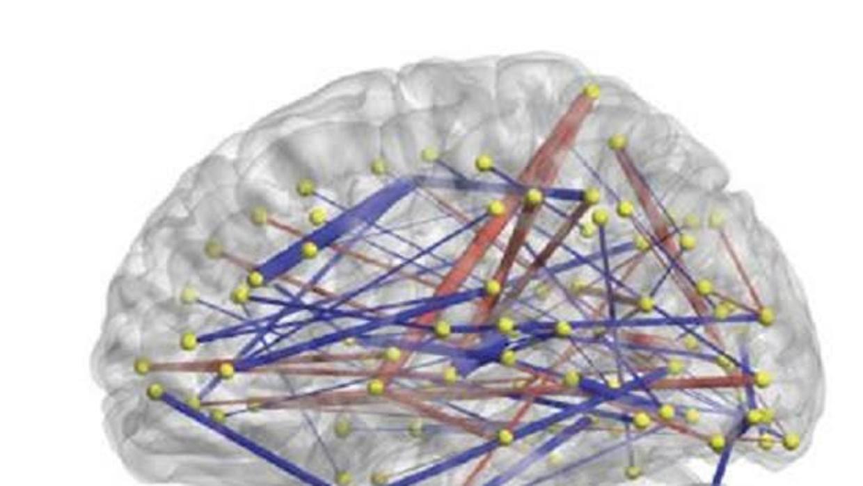 El análisis de las conexiones cerebrales permite predicir si un bebé padece TEA