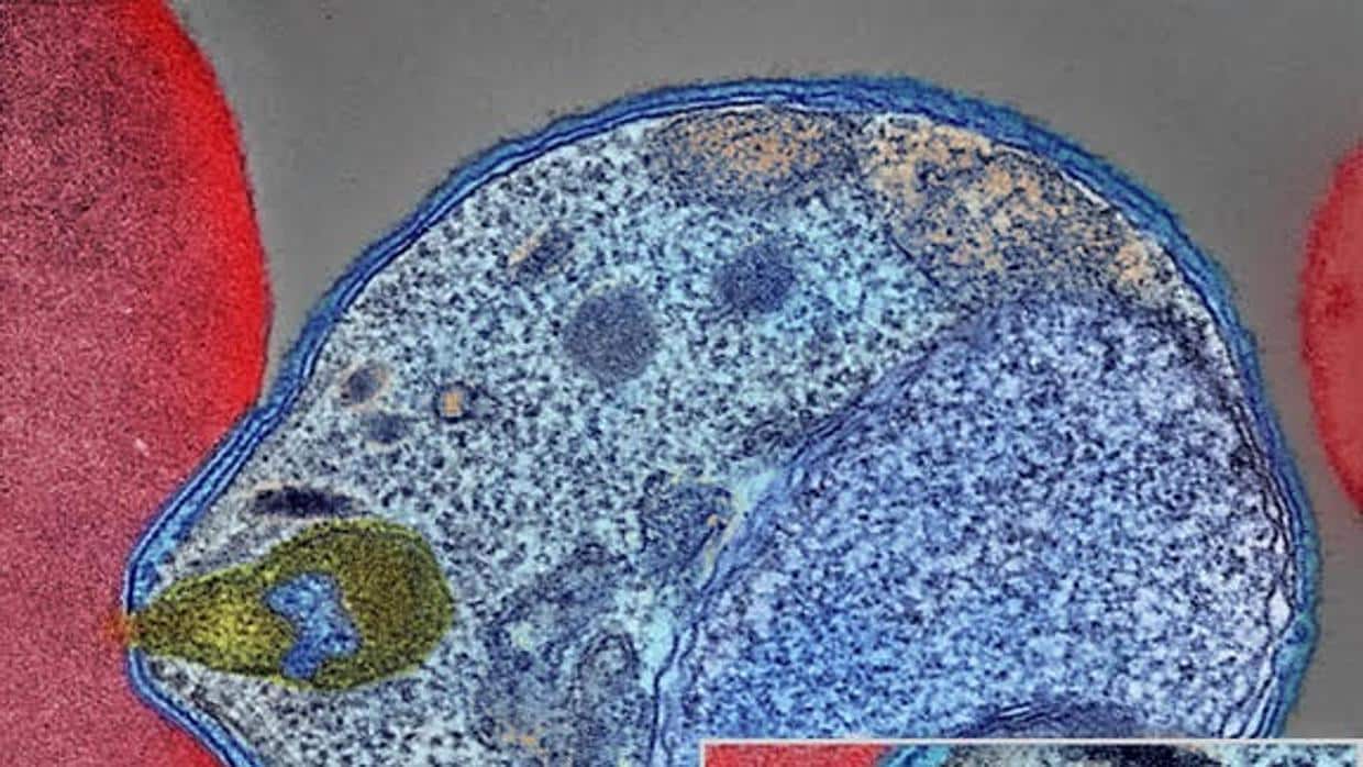 Imagen por microscopía electrónica de un merozoito unido a la membrana de un eritrocito
