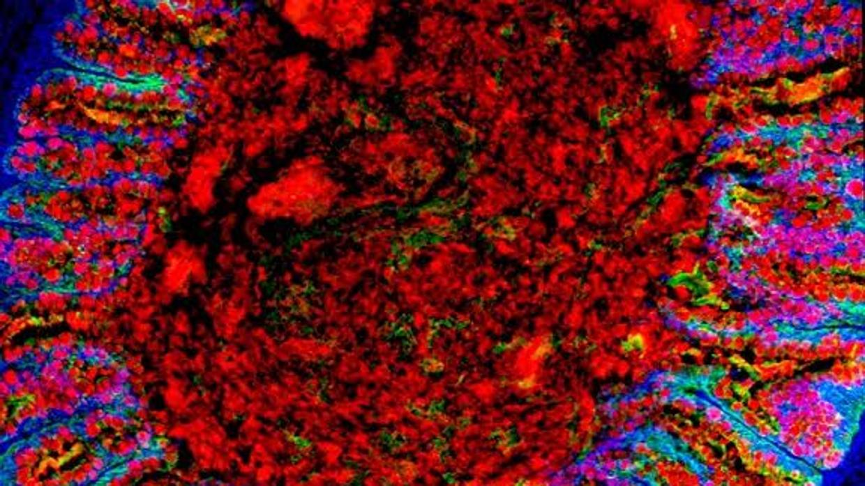 Imagen por microscopía confocal de un 'mini-colon' derivado de iPS humanas