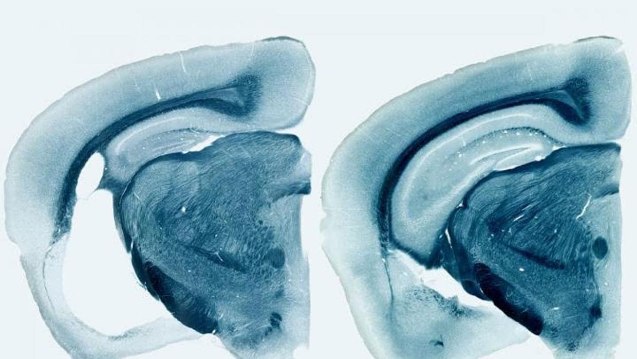 Reducción de áreas cerebrales en un ratón portador del gen ‘ApoE4’ humano (derecha)