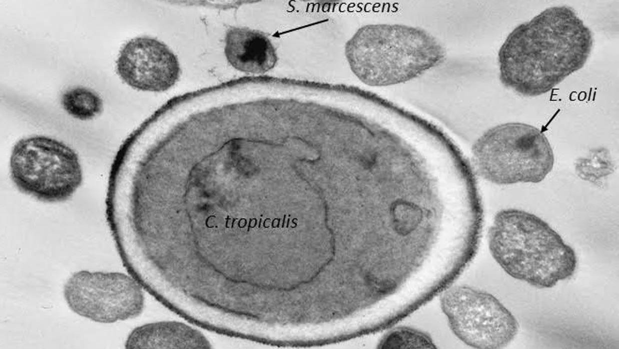 Interacción de 'E. coli' y 'S. marcescens' con 'C. tropicalis' en el intestino de un paciente con Crohn