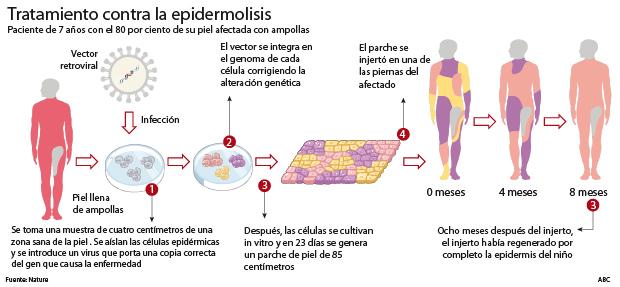 Un niño con «piel de mariposa» salva su vida con un injerto y terapia génica