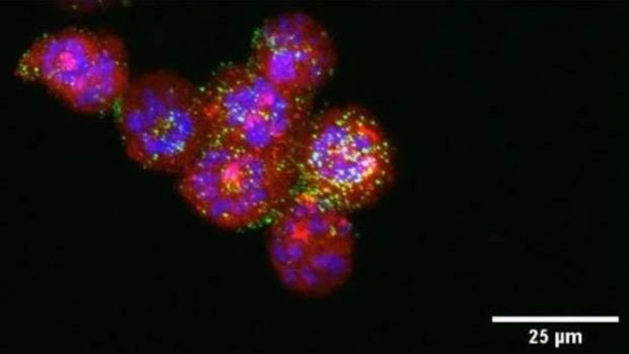 Ataque por las nanopartículas (en verde) sobre las células tumorales (en rojo)