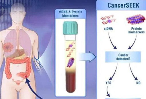 A partir de una muestra de sangre, la prueba analiza proteínas y biomarcadores que indican la presencia de cáncer