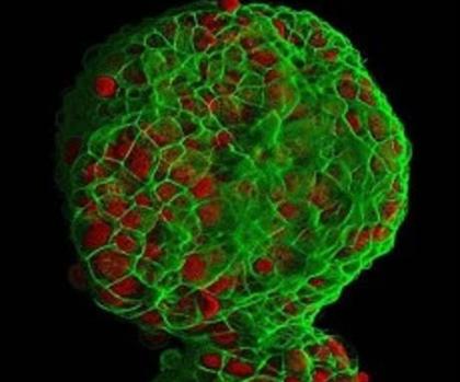 La dieta puede prevenir las metástasis en el cáncer de mama