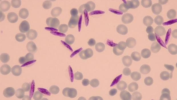 Hallada la manera de eliminar un elemento clave de la malaria