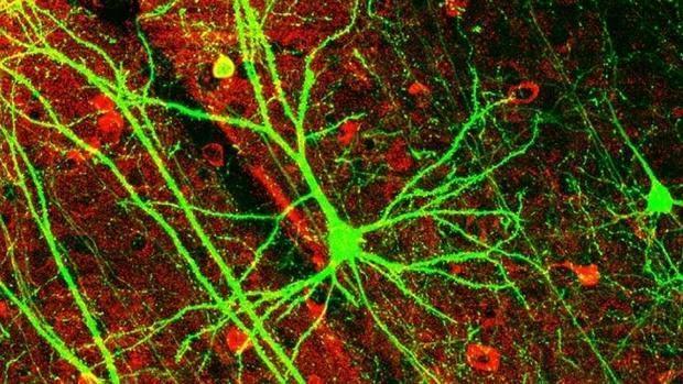 El déficit de neuronas dopaminérgicas permite detectar precozmente el alzhéimer