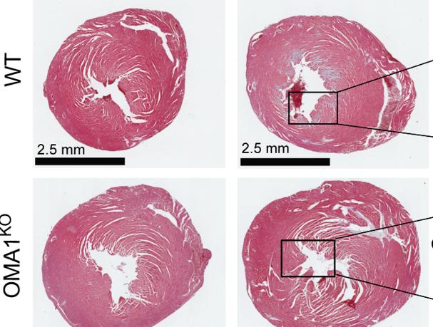 OMA1, la prometedora diana para el tratamiento de la insuficiencia cardíaca