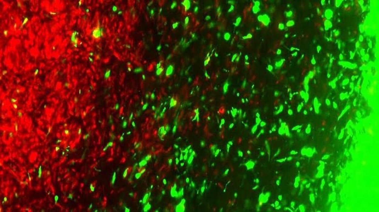 Células tumorales genéticamente editadas (en verde) se dirigien hacia las células de cáncer cerebral (en rojo)