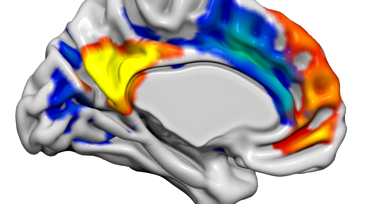 La imagen muestra dos redes cerebrales -Red de Modo Predeterminado- (rojo / amarillo) y la Red de Salud (azul / verde) que tienen roles importantes en la función social y emocional. Estas dos redes en el cerebro se alteraron cuando los voluntarios recibieron la hormona kisspeptina, y esto se asoció con cambios en la actividad cerebral relacionada con la aversión sexual y la excitación sexual.