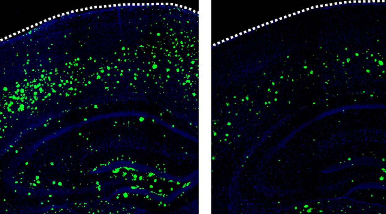 3K3A-APC (derecha) reduce en gran medida la cantidad de amiloide-β (verde) que se acumula en los cerebros de ratones que desarrollan síntomas similares al Alzheimer en comparación con ningún tratamiento (izquierda)