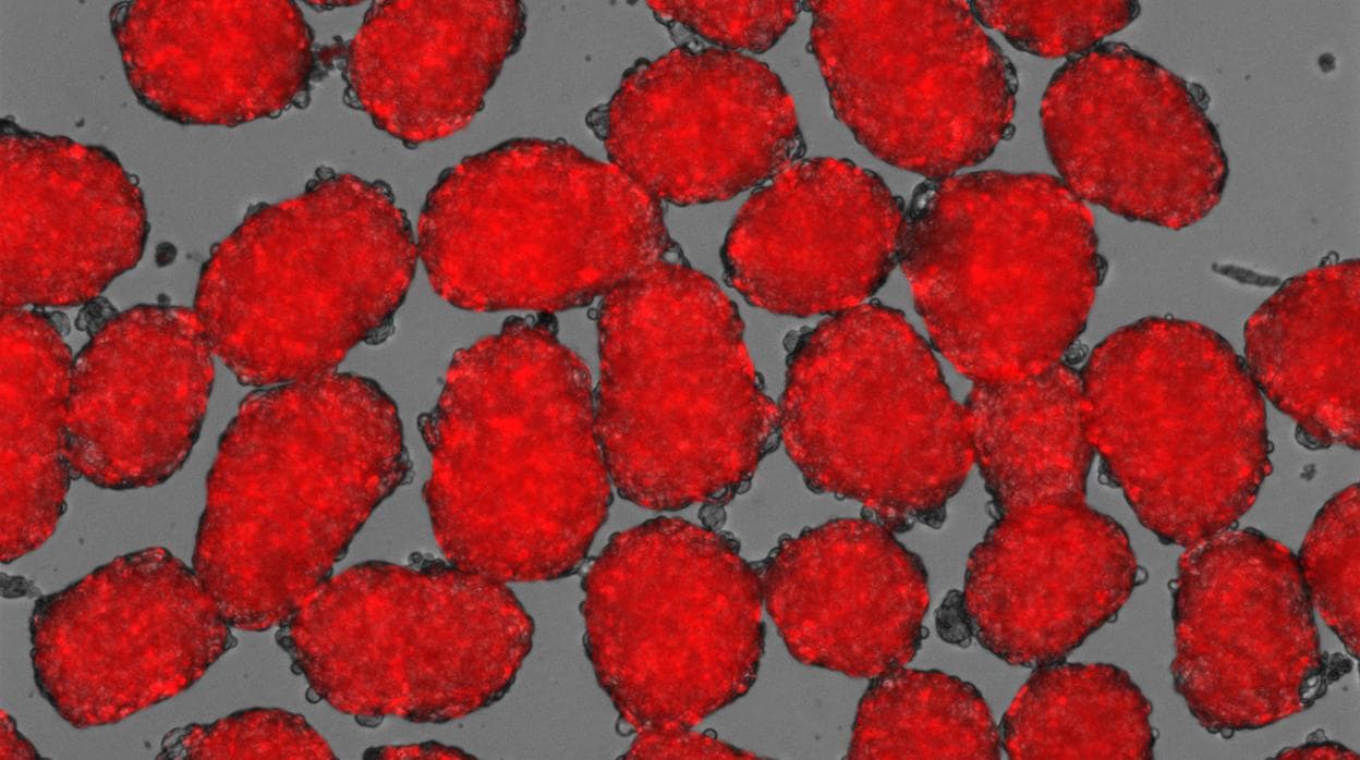 Las nuevas células beta aparecen en rojo cuando segregan insulina en respuesta a la glucosa.