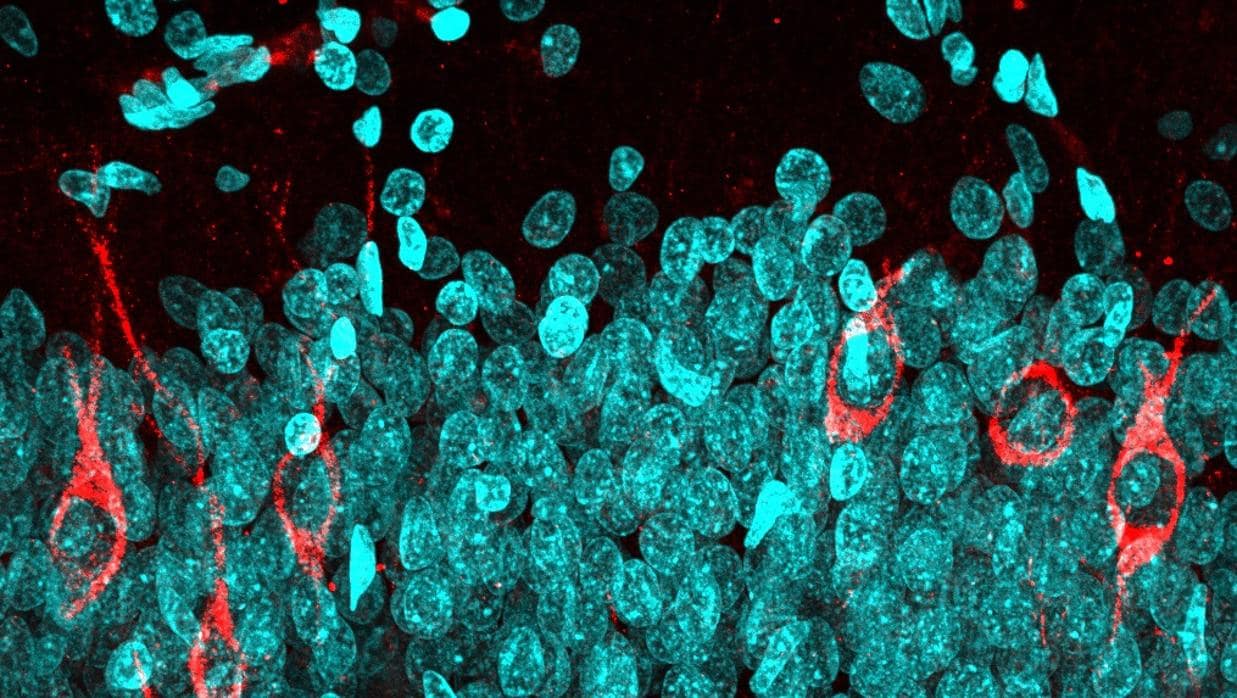 Neuronas inmaduras (rojo) y neuronas maduras (azul) en el giro dentado de un sujeto cognitivamente sano de 68 años de edad.