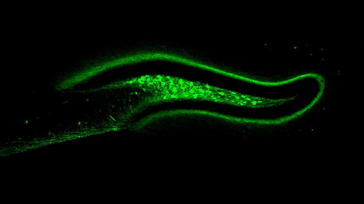 Las neuronas que evitarán que no paremos de comer