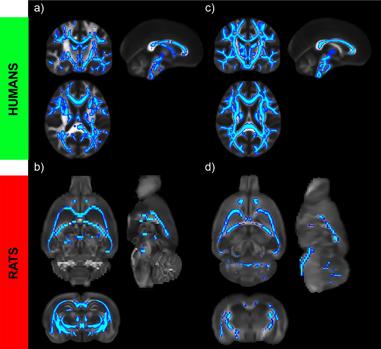 Cambios microestructurales en la sustancia blanca del cerebro en alcohólicos humanos (a) y en ratas expuestas al alcohol (b). Los cambios observados avanzan aún más después de dos semanas de abstinencia en ambas especies, como se muestra en los paneles c para humanos y d para ratas