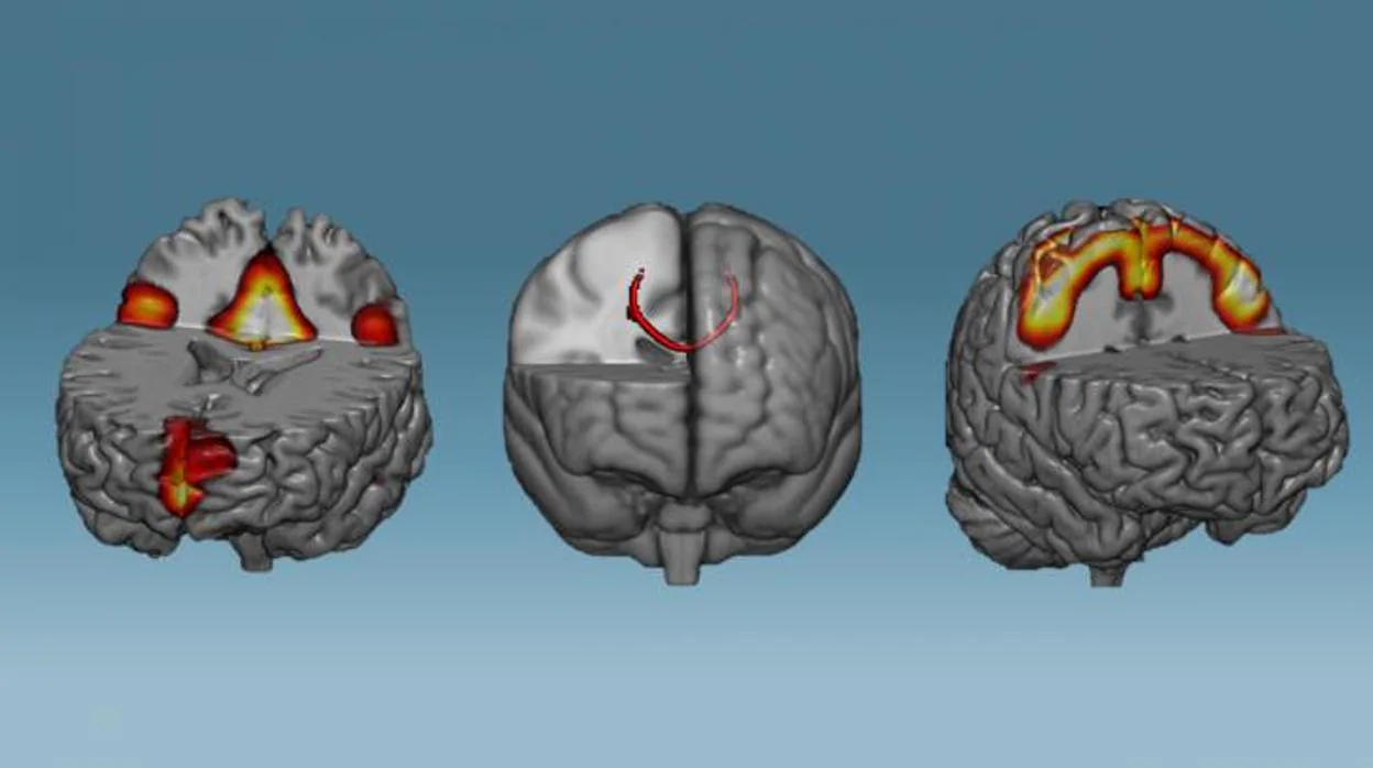 Las redes neuronales que mostraron una mayor conectividad después de una hora de entrenamiento neurofeedback: redes en modo predeterminado (izquierda), cuerpo calloso (medio) y redes sensoriomotoras (derecha).