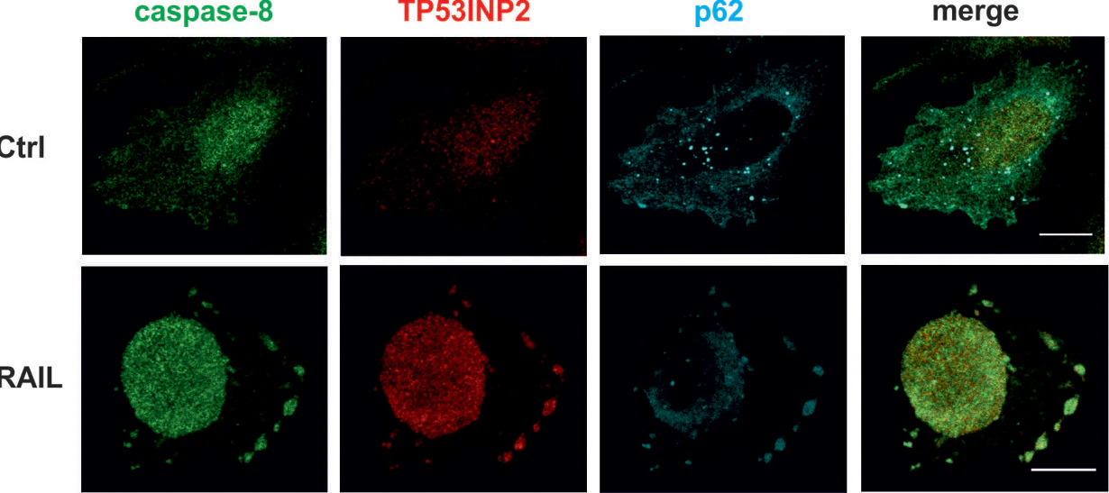 Diferentes localizaciones de las proteínas involucradas en apoptosis en condiciones basales (Ctrl) y con inducción de los receptores de muerte celular con TRAIL