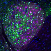 Amigdala que contiene neuronas Prepronociceptina (verde) y PKC delta (magenta