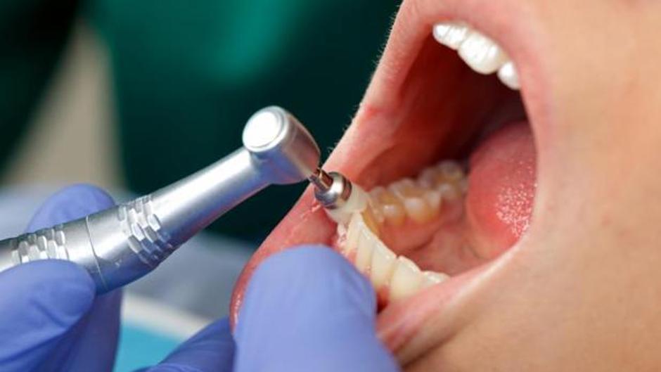 Los dentistas y Facua avisan de no usar este producto de Lidl