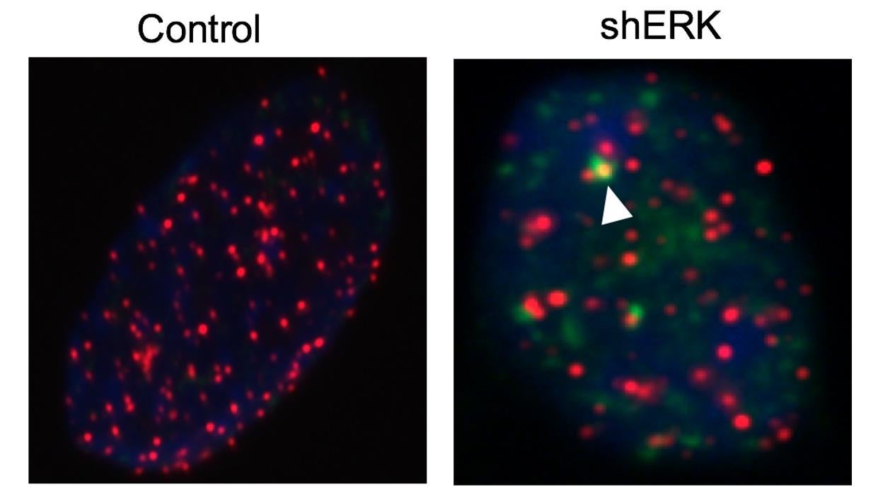 iEl estudio dentifica nuevas combinaciones de fármacos que, en ratones, evitan la aparición de resistencias en el tratamiento contra glioblastoma