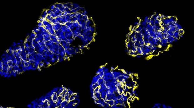 Investigadores españoles hallan cómo mejorar el trasplante para tratar la diabetes tipo 1