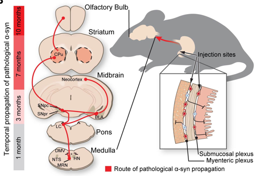 El origen del párkinson está en el intestino