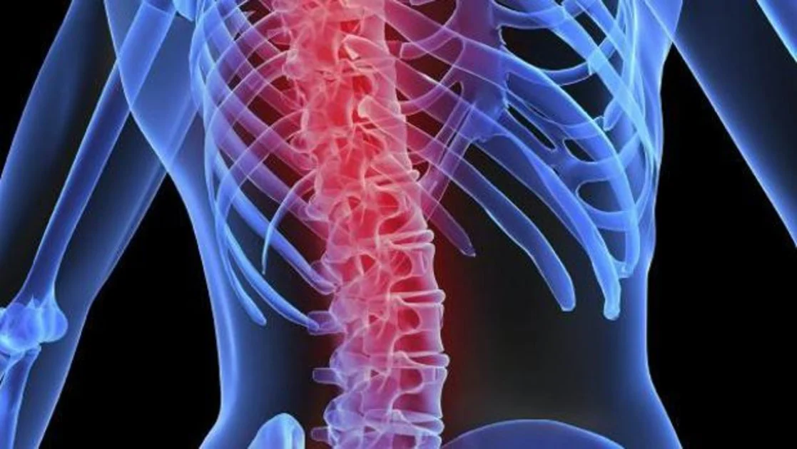 Las fracturas por osteoporosis suelen afectar, fundamentalmente, a las muñecas, la cadera, el húmero y la columna vertebral