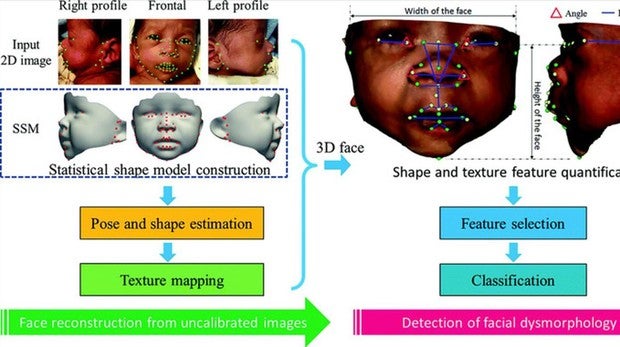 Un método de análisis facial detecta síndromes genéticos con alta precisión