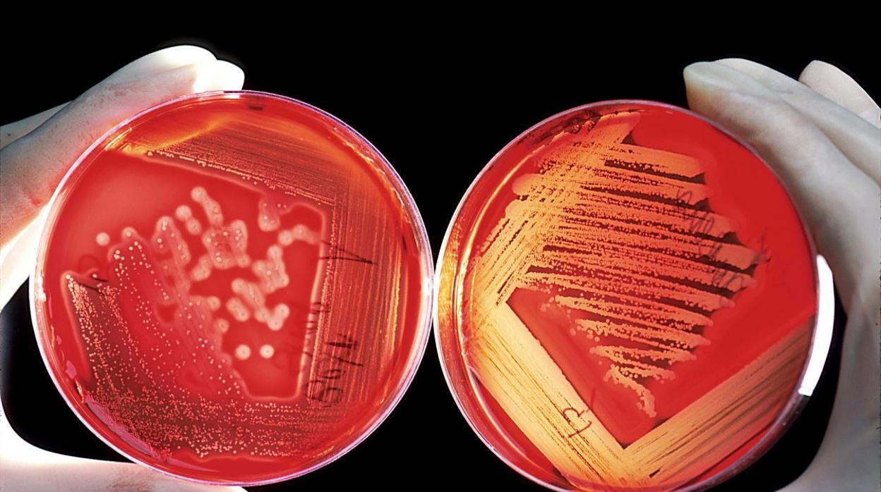 Los mecanismos por los cuales se produce la fibrosis cardíaca no se conocen en su totalidad y no existen terapias eficaces para revertirla