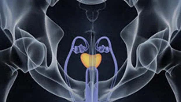 La IA es tan buena para identificar el cáncer de próstata como los mejores uropatólogos
