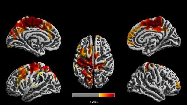 El lugar donde vives y el aire que respiras puede afectar la forma en que se desarrolla tu cerebro