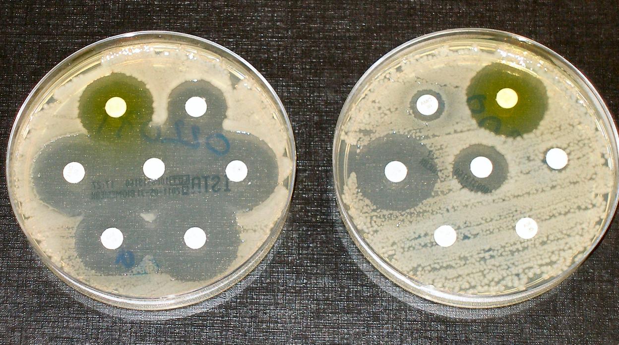 Los análisis para conocer la concentración de antibiótico necesaria en tratamientos se realizan habitualmente en cultivos donde cada especie vive sola