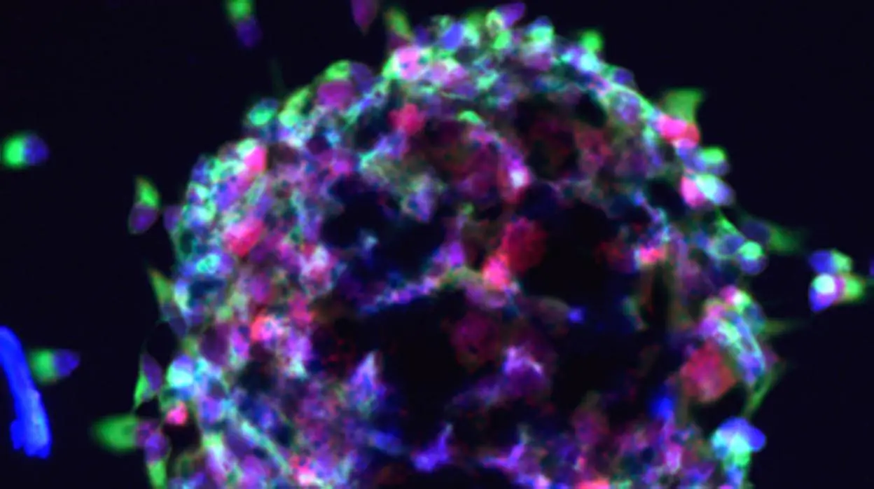 Células madre pluripotentes